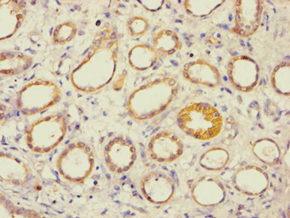 AES / Groucho Antibody (aa1-264)