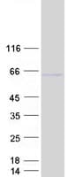 Human ZIC2 Protein (Recombinant Myc-DDK (Flag))