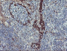 TSC22D1 / TSC22 Antibody (clone OTI3B7)