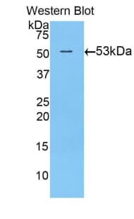 TGM1 / Transglutaminase Antibody (aa504-737)