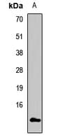 Polyclonal Rabbit anti-Human POLR2F Antibody (IF, WB)