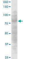 CLLP / CTNNAL1 Antibody (clone 3C8)