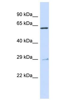 Polyclonal Rabbit anti-Human MYB / c-Myb Antibody (aa503-552, WB)