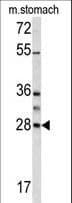 Polyclonal Rabbit anti-Human GZMB / Granzyme B Antibody (aa2-32, IHC, WB)