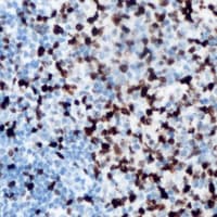 Polyclonal Rabbit anti-Human CARP / ANKRD1 Antibody (C-Terminus, IHC, WB)