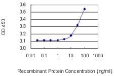 Gastrin Releasing Peptide Antibody (clone 3A11)