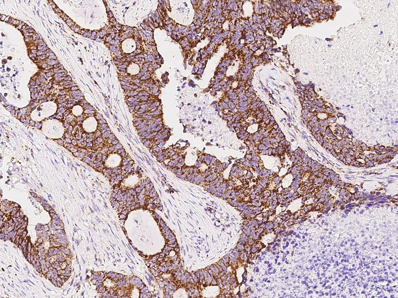 HADH Antibody (Preservative Free)