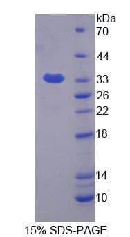 Human FMO1 Protein (Recombinant His-T7)