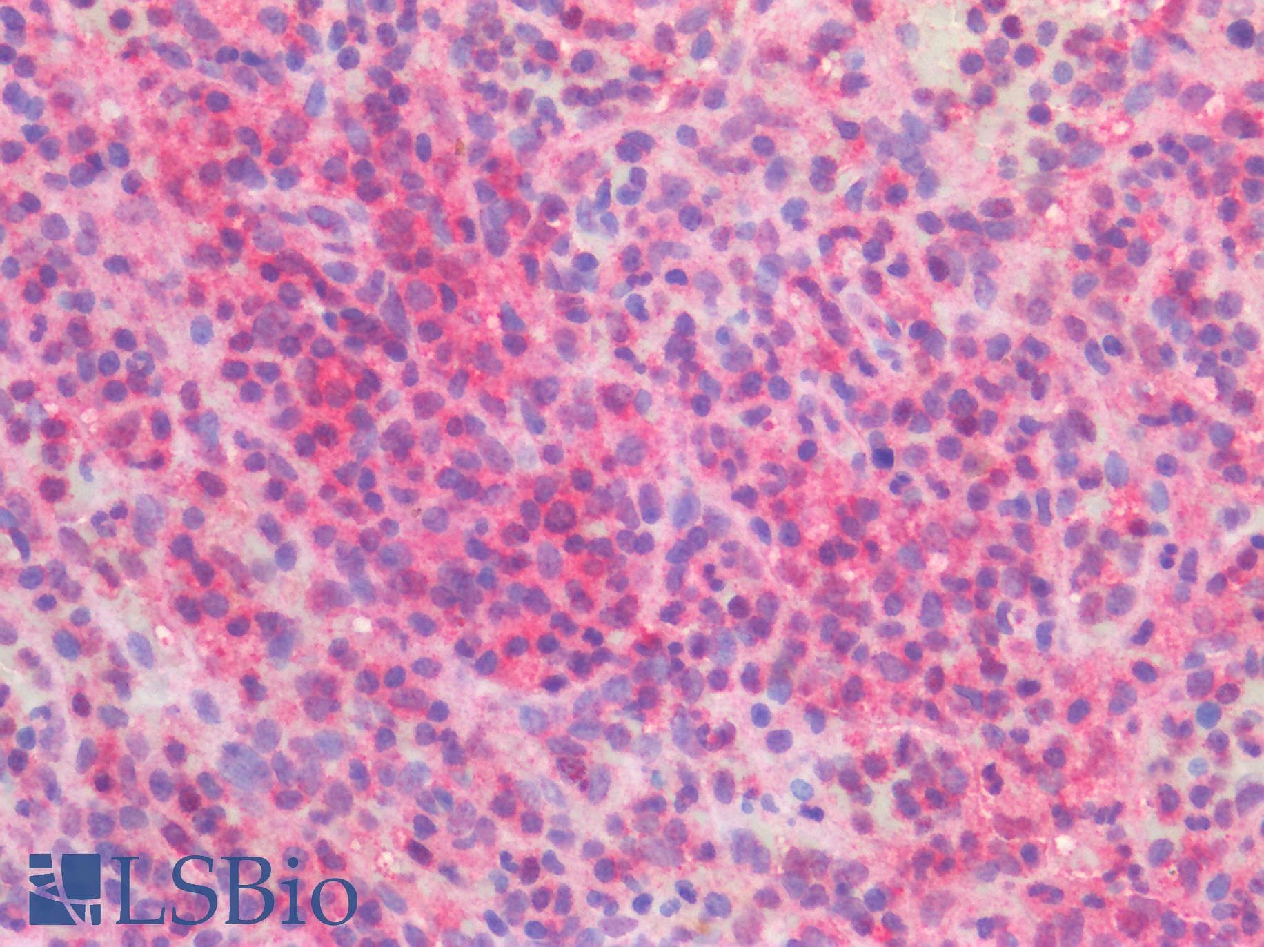PathPlus™ BRAF / B-Raf Antibody