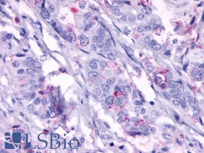 IHC-plus™ Polyclonal Rabbit anti-Human ADGRA2 / GPR124 Antibody (N-Terminus, IHC)