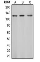 Polyclonal Rabbit anti-Human c-CBL Antibody (phospho-Tyr774, IHC, IF, WB)