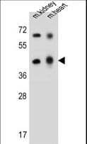 Polyclonal Rabbit anti-Human ADAL Antibody (aa317-344, IHC, WB)