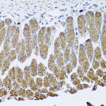 NTRK1 / TrkA Antibody