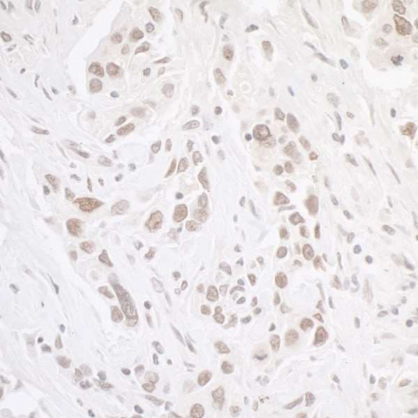 CSNK2A1 Antibody (aa300-350)