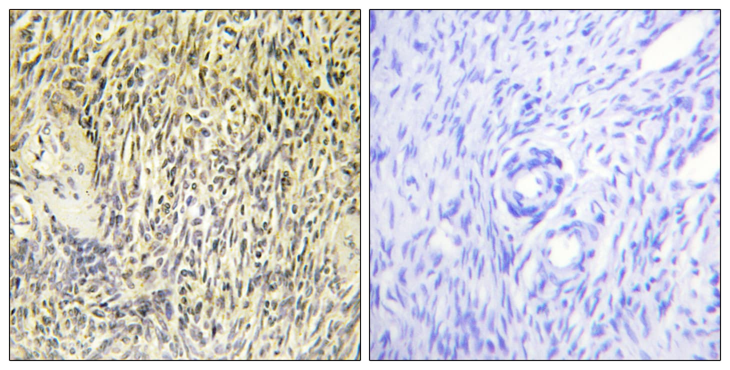 SYK Antibody (aa289-338)
