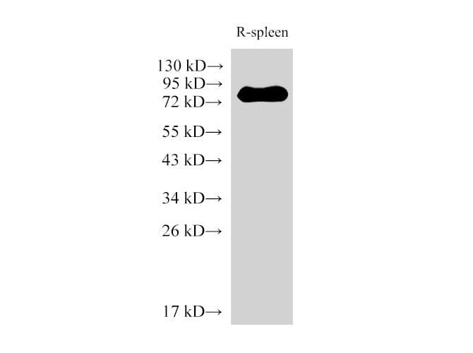 IL6R / IL6 Receptor Antibody
