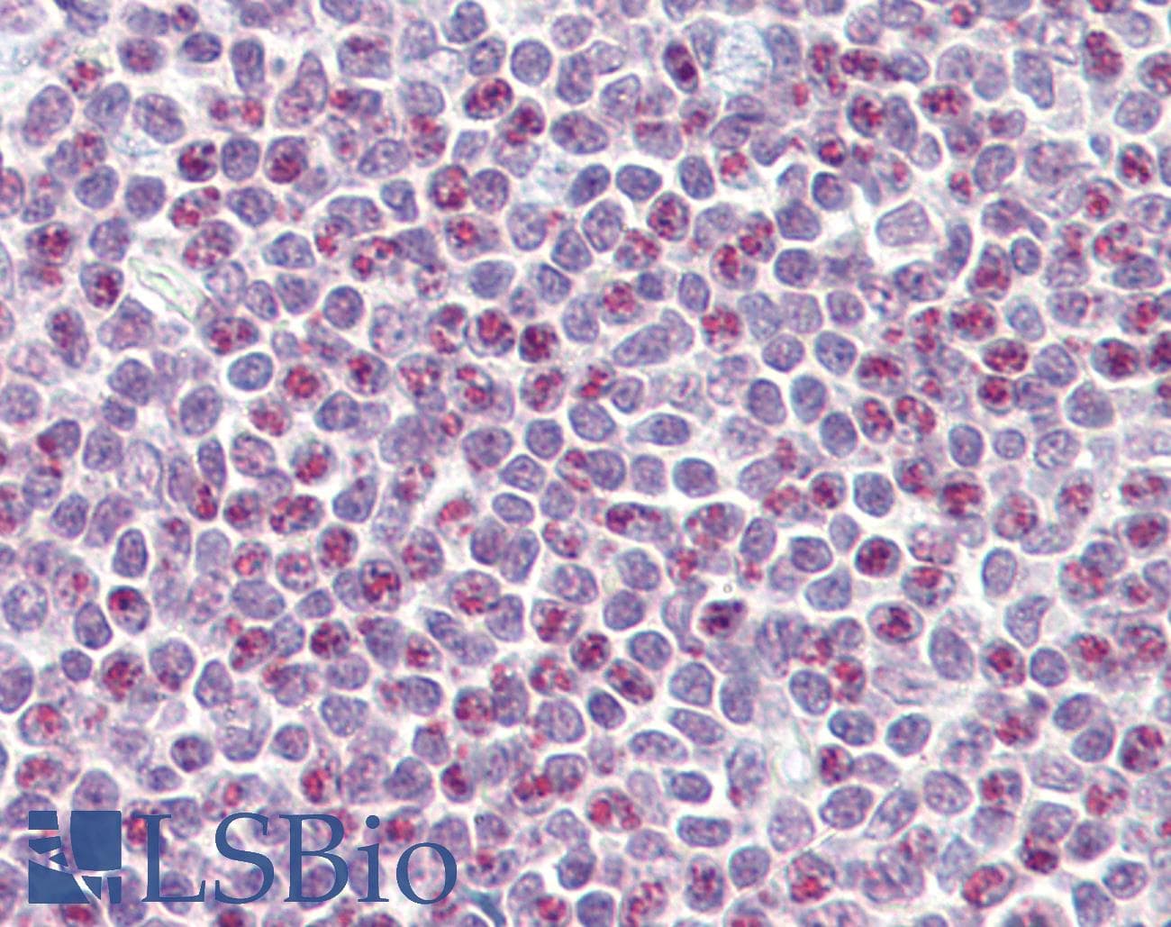 IHC-plus™ Polyclonal Goat anti-Human APOBEC3A Antibody (aa7-20, IHC, IF, WB)