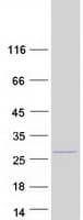 Human VPS29 Protein (Recombinant Myc-DDK (Flag))
