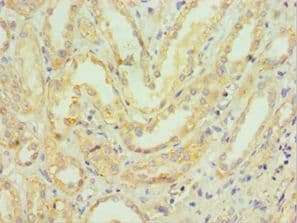 HMGN4 Antibody (aa1-90)