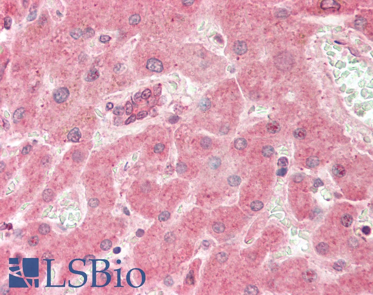 Polyclonal Rabbit anti-Human RELA / NFKB p65 Antibody (C-Terminus, IHC, WB)