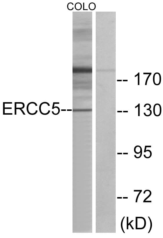 IHC-plus™ Polyclonal Rabbit anti-Human ERCC5 / XPG Antibody (aa131-180, IHC, WB)