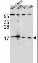 FGF22 Antibody (aa18-46)