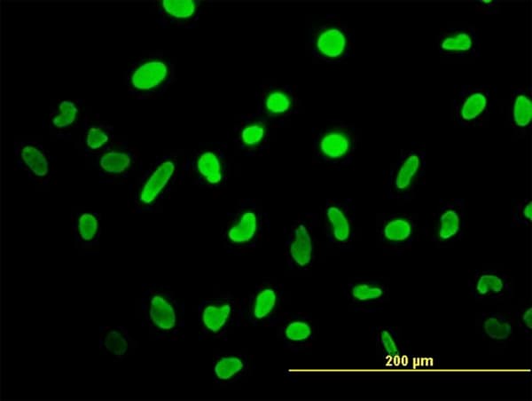 IHC-plus™ Monoclonal Mouse anti-Human HMG2 / HMGB2 Antibody (clone 3D2, IHC, IF, WB)