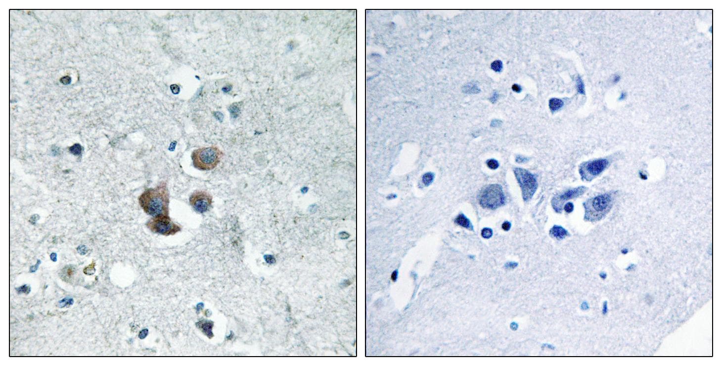 IGFBP7 / TAF Antibody