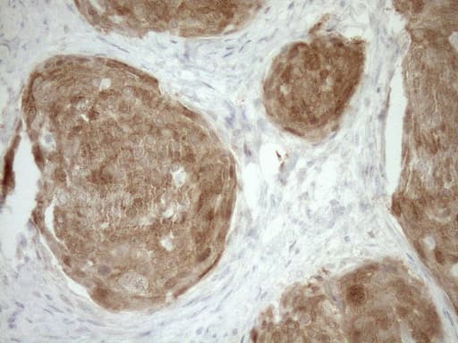 p16INK4a / CDKN2A Antibody (clone OTI1H3)