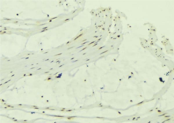 CCDC8 Antibody