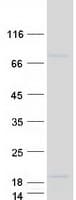 Human SMIM19 / C8orf40 Protein (Recombinant Myc-DDK (Flag))