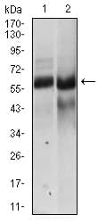 IHC-plus™ HAS2 Antibody (clone 4E7)