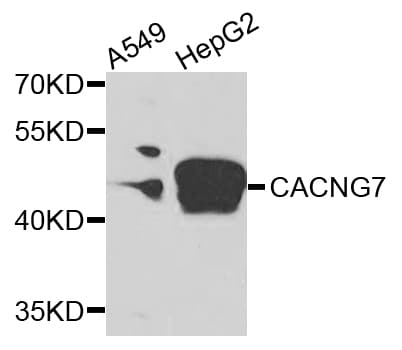 CACNG7 Antibody