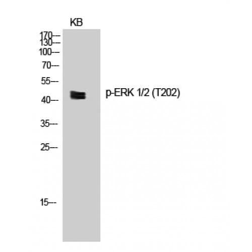 Polyclonal Rabbit anti-Human ERK1 + ERK2 Antibody (140-220 aa, WB)