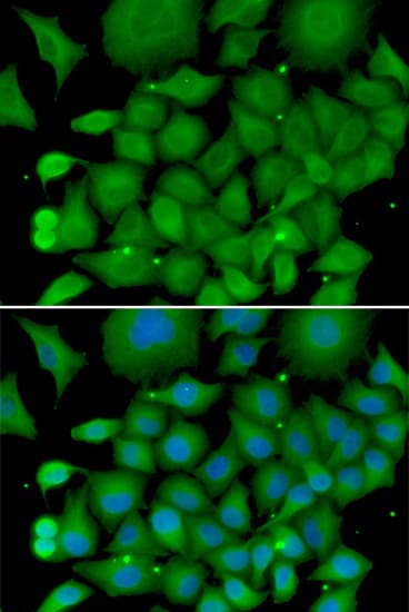 SOD3 Antibody