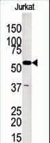 GK2 / Glycerol Kinase 2 Antibody (aa487-515)