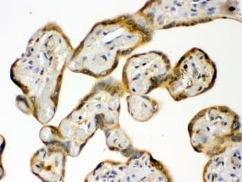 Polyclonal Rabbit anti-Human HSP90 Beta Antibody (IHC, WB)