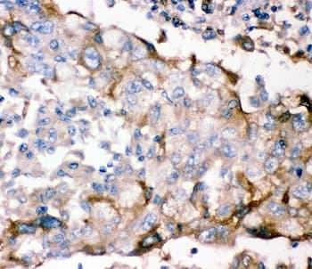 Polyclonal Rabbit anti-Human GFRA1 / GFR Alpha Antibody (aa25-227, IHC, WB)