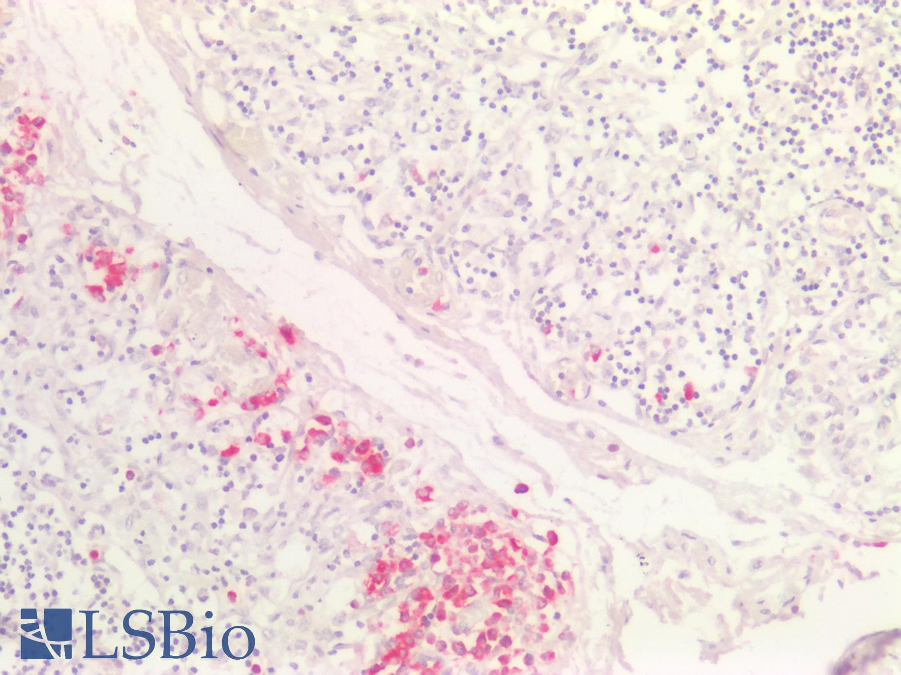 PathPlus™ HNE / Neutrophil Elastase Antibody