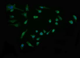 SYP / Synaptophysin Antibody (clone OTI1G6)