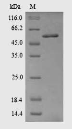 Rat Acetyl-CoA Carboxylase / ACC Protein (Recombinant 6His, N-terminus)