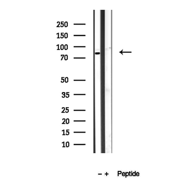 BBS10 Antibody