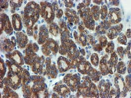 PPAT Antibody (aa42-278, clone OTI1B8)
