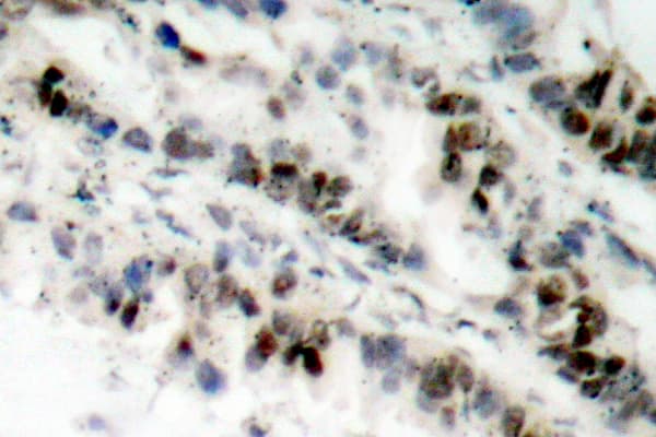 SMC1A / SMC1 Antibody (phospho-Ser957)
