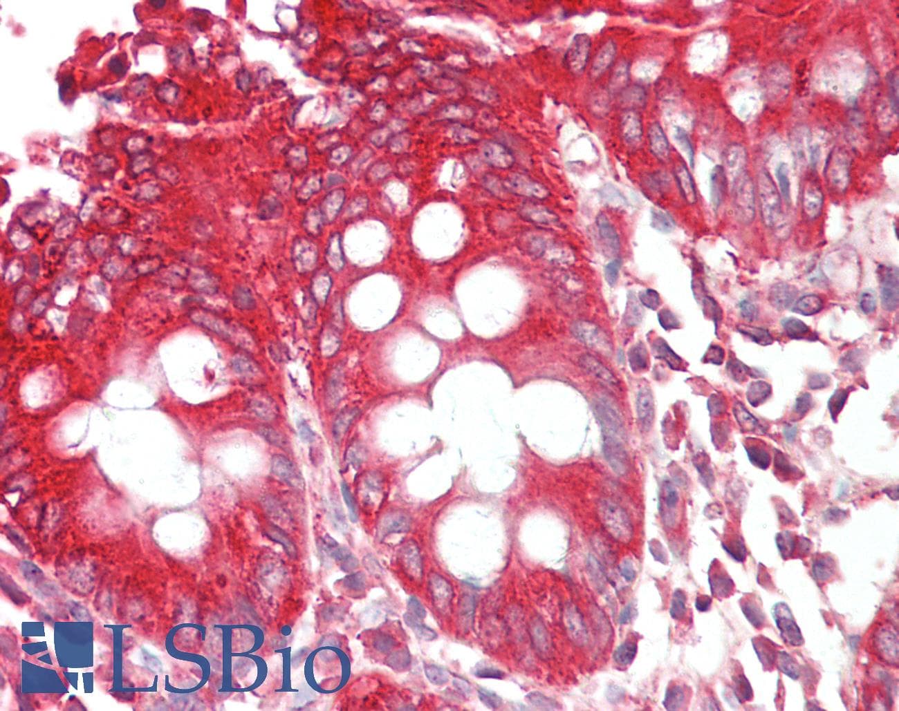 IHC-plus™ SH3GLB1 / Bif / Endophilin B1 Antibody (aa373-386)