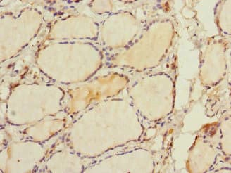 RHOBTB1 Antibody