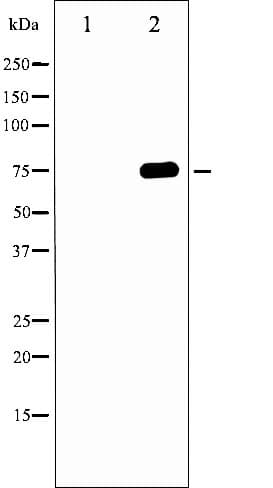 MAPT / Tau Antibody (phospho-Thr231)