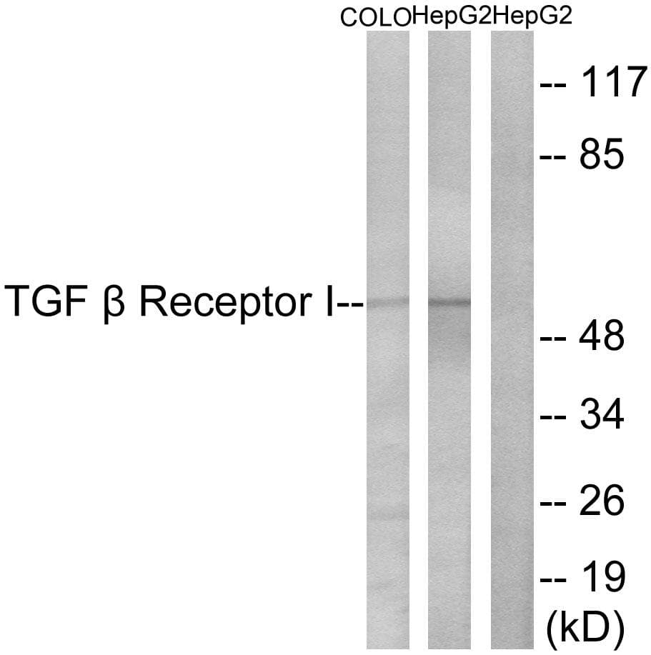 TGFBR1 / ALK5 Antibody (p165)