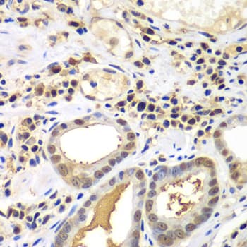 PSME2 Antibody