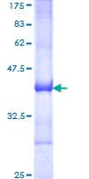 Human MACS / RIN2 Protein (Recombinant GST, N-terminus)
